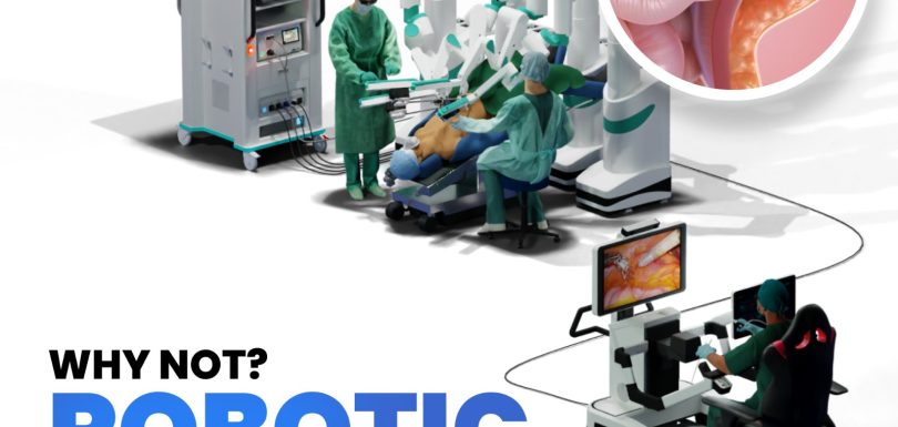 robotic hernia surgery hernia surgery in Surat robotic surgery in Surat best hospital in Surat for hernia hernia specialist in Surat Gujarat advanced surgical hospital in Surat minimally invasive surgery in Suratrobotic hernia surgery in India robotic hernia surgery in Surat minimally invasive hernia surgery advanced hernia surgery hernia surgery specialist robotic surgery benefits laparoscopic vs robotic hernia surgery hernia repair surgery best hernia doctor in Surat painless hernia surgery hernia treatment hospital in Gujarat robotic surgery hospital in India inguinal hernia treatment umbilical hernia surgery incisional hernia repair cost of robotic hernia surgery in India recovery time after robotic hernia surgery is robotic hernia surgery safe best hospital for hernia surgery in Surat advantages of robotic hernia surgery robotic vs laparoscopic hernia surgery which is better hernia surgery without pain fastest recovery hernia surgery method hernia treatment with minimal scars