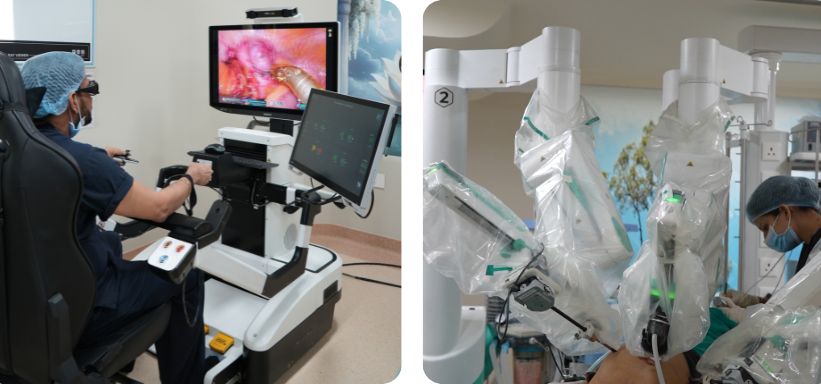 Dhameliya Kidney Hospital and Lithotripsy Center Dhameliya Kidney Hospital Surat Dr. Arvind Dhameliya Robotic Surgeon Dhameliya Hospital Gallbladder Department Best robotic surgery hospital in Surat Top gallbladder surgeon in Surat Robotic cholecystectomy in Surat Gujarat Laparoscopic gallbladder removal Surat Gallstone treatment center in Lal Darwaja Surat Affordable robotic surgery cost in Surat Robotic-assisted gallbladder surgery benefits Minimally invasive cholecystectomy vs open surgery Single-site robotic gallbladder surgery Precision robotic surgery for gallstones Advanced robotic care for kidney and gallbladder Post-operative recovery for robotic gallbladder removal Best hospital for robotic gallbladder surgery in India Top-rated lithotripsy and robotic center Best urologist and robotic surgeon in Surat Robotic vs Laparoscopic gallbladder surgery: Which is better? Best hospital for gallstone removal with laser and robot How long is recovery after robotic gallbladder surgery? Is robotic surgery safer for gallbladder removal? Success rate of robotic gallbladder surgery at Dhameliya Hospital. Pain levels after robotic cholecystectomy.