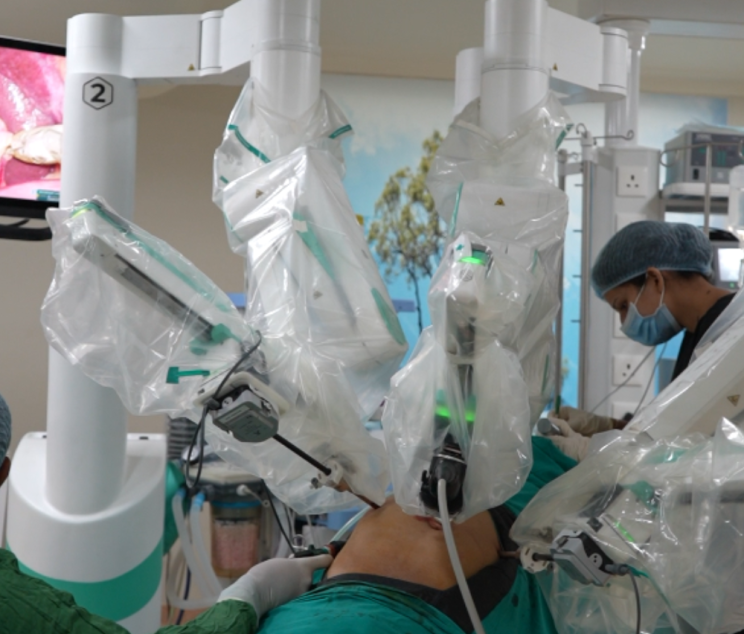 Dhameliya Kidney Hospital and Lithotripsy Center Dhameliya Kidney Hospital Surat Dr. Arvind Dhameliya Robotic Surgeon Dhameliya Hospital Gallbladder Department Best robotic surgery hospital in Surat Top gallbladder surgeon in Surat Robotic cholecystectomy in Surat Gujarat Laparoscopic gallbladder removal Surat Gallstone treatment center in Lal Darwaja Surat Affordable robotic surgery cost in Surat Robotic-assisted gallbladder surgery benefits Minimally invasive cholecystectomy vs open surgery Single-site robotic gallbladder surgery Precision robotic surgery for gallstones Advanced robotic care for kidney and gallbladder Post-operative recovery for robotic gallbladder removal Best hospital for robotic gallbladder surgery in India Top-rated lithotripsy and robotic center Best urologist and robotic surgeon in Surat Robotic vs Laparoscopic gallbladder surgery: Which is better? Best hospital for gallstone removal with laser and robot How long is recovery after robotic gallbladder surgery? Is robotic surgery safer for gallbladder removal? Success rate of robotic gallbladder surgery at Dhameliya Hospital. Pain levels after robotic cholecystectomy.